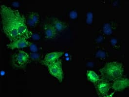 Monoclonal Mouse anti-Human TBC1D4 / AS160 Antibody (clone OTI5A6, IF, WB)