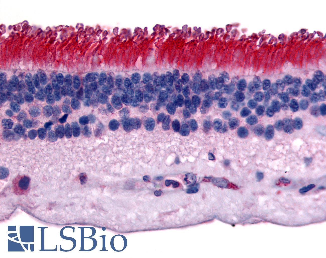 IHC-plus™ Polyclonal Rabbit anti-Human PTPRM / PTP Mu Antibody (Internal, IHC)