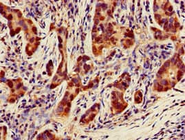 Polyclonal Rabbit anti-Human NQO1 Antibody (IHC, IF)