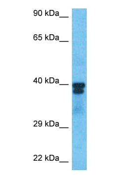 PAX6 Antibody (C-Terminus, FITC)