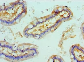 ROCK2 Antibody (aa1109-1388)