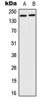 HCF1 / HCFC1 Antibody (N-Terminus)