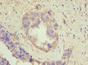 ATP5B / ATP Synthase Beta Antibody (aa230-529)