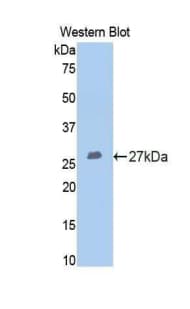 COMP / THBS5 Antibody (aa554-753)