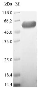 Human ENGASE Protein (Recombinant 6His-SUMO, N-terminus)
