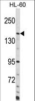 ADCY8 / Adenylate Cyclase 8 Antibody (aa946-972)