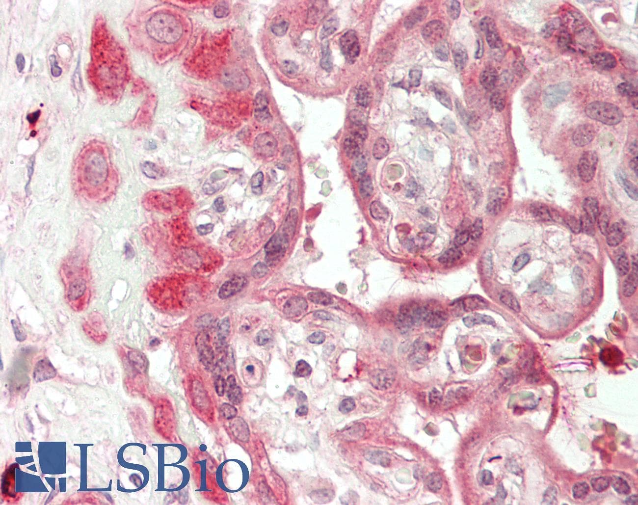 IHC-plus™ Polyclonal Rabbit anti-Human METTL13 / KIAA0859 Antibody (aa650-700, IHC, WB)