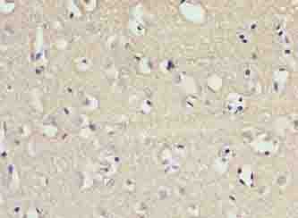 SLC22A17 Antibody