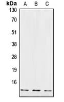 CSTB / Cystatin B / Stefin B Antibody (Internal)