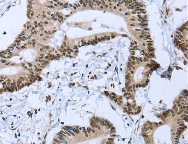 ZMAT3 Antibody