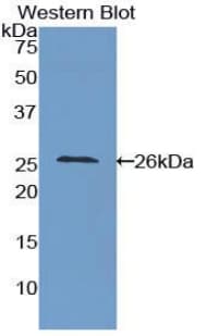ICAM4 / CD242 Antibody (aa32-226)