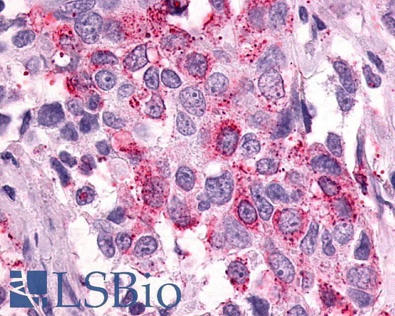 IHC-plus™ Polyclonal Rabbit anti-Human PTGER3 / EP3 Antibody (Cytoplasmic Domain, IHC)