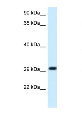 Polyclonal Rabbit anti-Human MRPL19 Antibody (C-Terminus, WB)