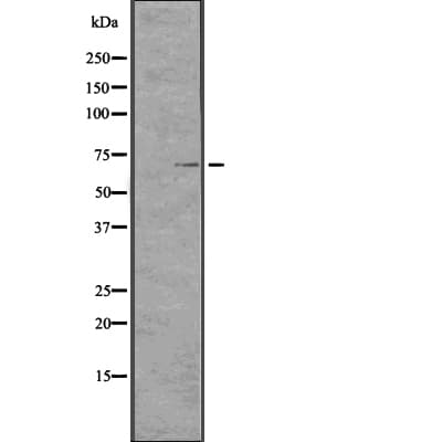 TCHP Antibody