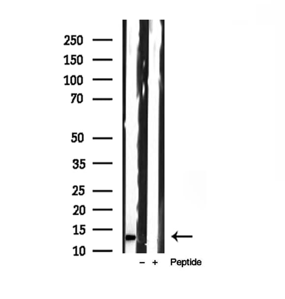 FXYD1 / Phospholemman Antibody