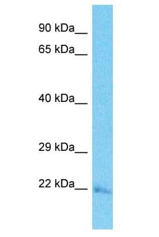 TATDN3 Antibody (C-Terminus)