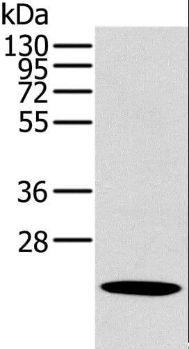 OTUB2 Antibody