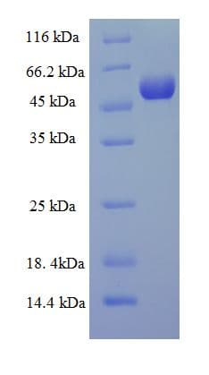 Human TPST2 Protein (Recombinant His-SUMO)