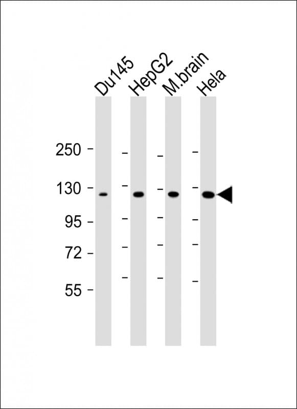 DAB2IP Antibody (aa782-1038, clone 1626CT702.263.21)