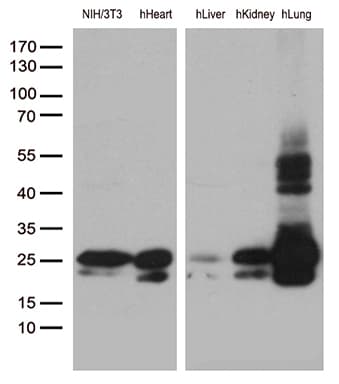 Monoclonal Mouse anti-Human CAV1 / Caveolin 1 Antibody (clone OTI2C4, Carrier-free, aa2-104, IHC, WB)