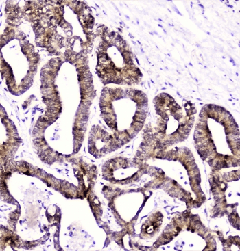 DDT / Dopamine Tautomerase Antibody