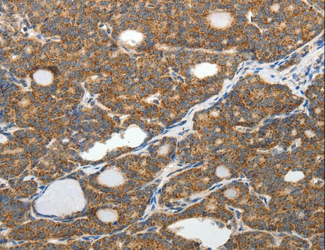 SLC12A4 / KCC1 Antibody