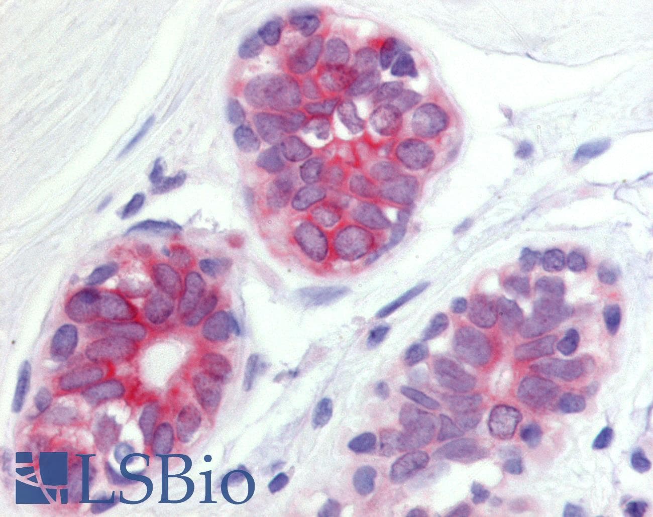 IHC-plus™ WNT6 Antibody (Internal)