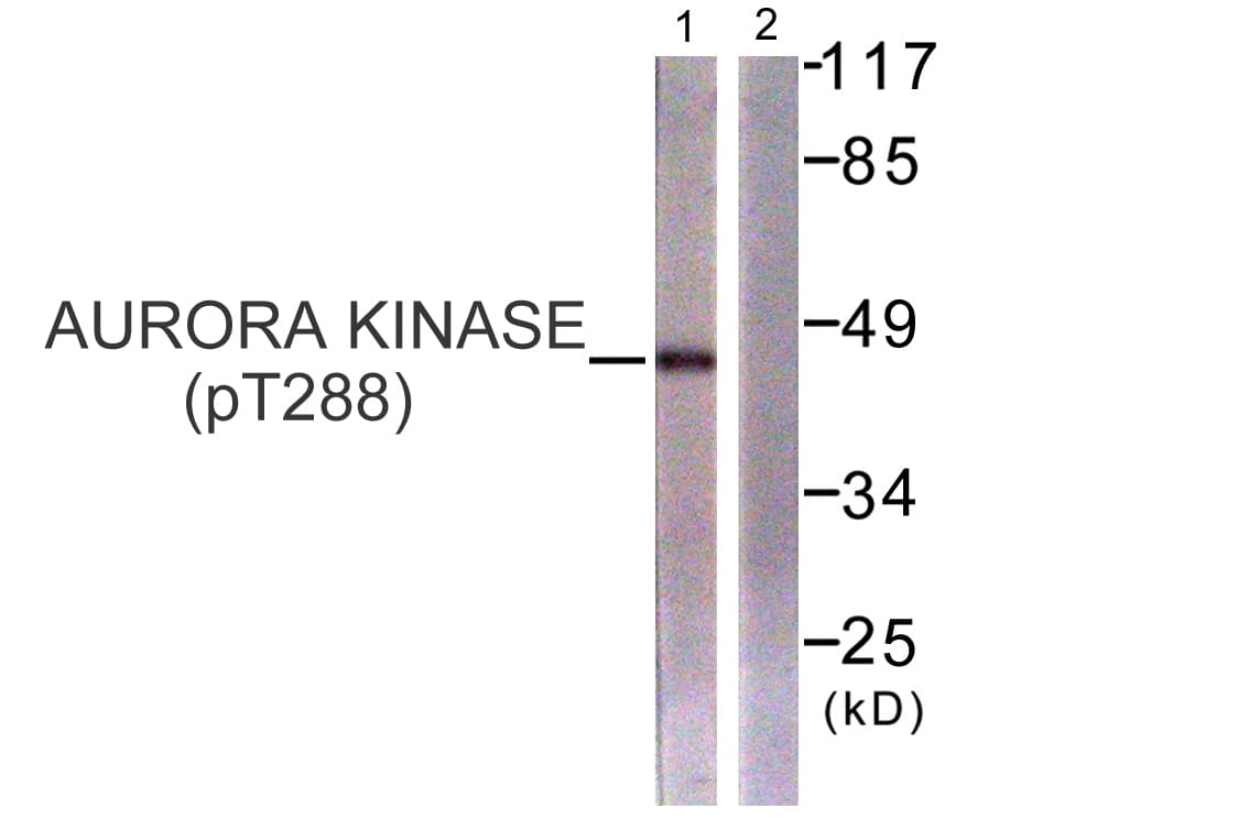AURKA / Aurora-A Antibody (phospho-Thr288)
