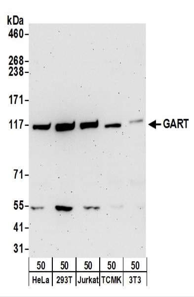 IHC-plus™ Polyclonal Rabbit anti-Human GART / GARS Antibody (aa200-250, IHC, WB)