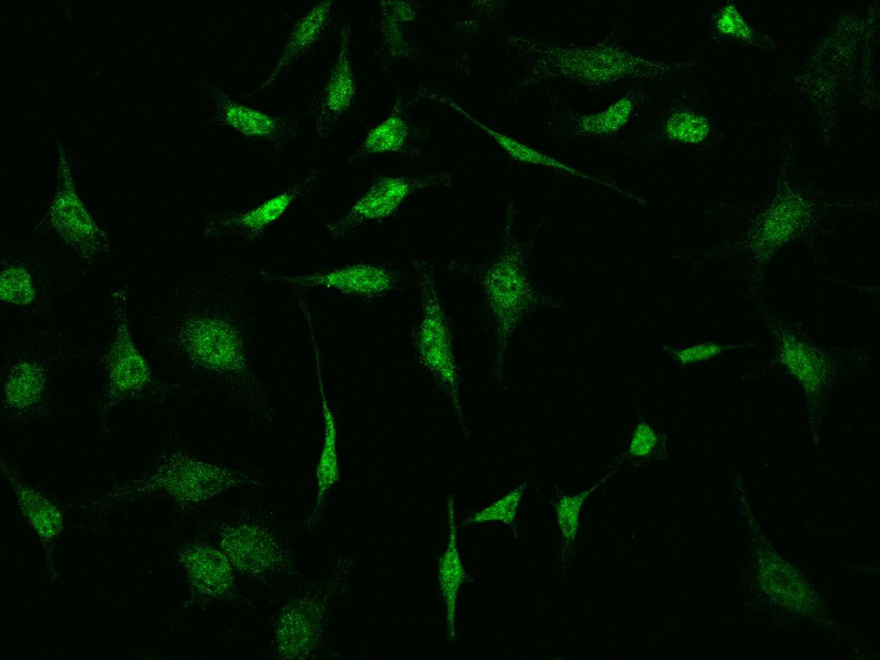 S100P Antibody (Preservative Free)