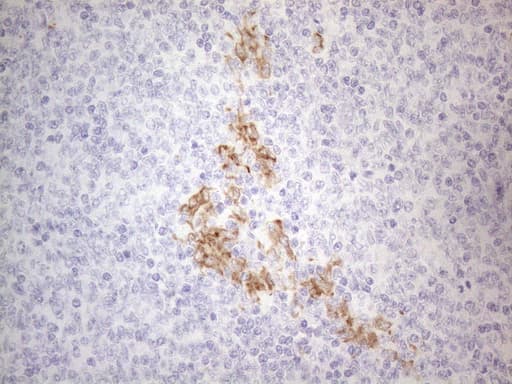 APOBR / APOB48R Antibody (aa780-1088, clone OTI1B5, Carrier-free)