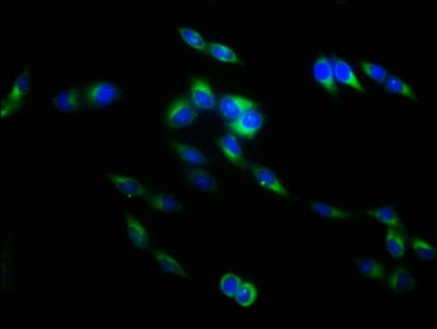 Polyclonal Rabbit anti-Human TNFSF9 / CD137L Antibody (IHC, WB)