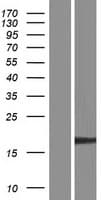 Human EXOSC3 Protein (Over-Expression Lysate Myc-DDK (Flag))
