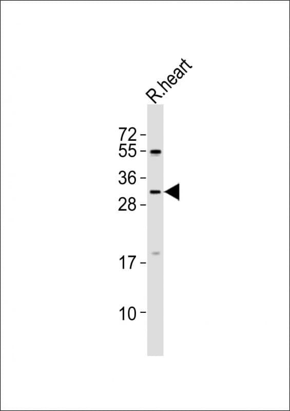HAND1 Antibody (aa83-116)