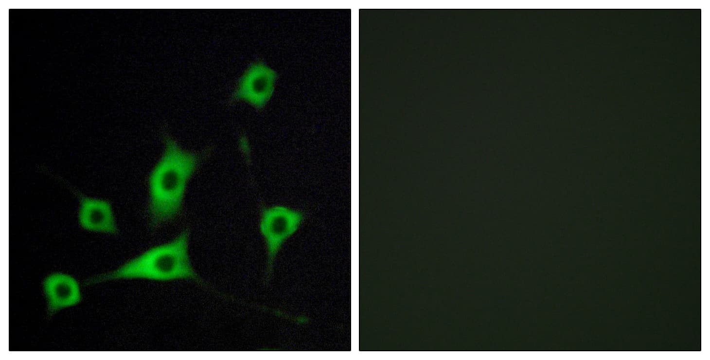 IHC-plus™ Polyclonal Rabbit anti-Human RBP5 Antibody (aa10-59, IHC, IF)
