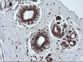 TRMT2A Antibody (clone OTI3B3)
