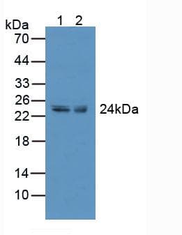 TNFRSF9 / 4-1BB / CD137 Antibody (aa40-153)