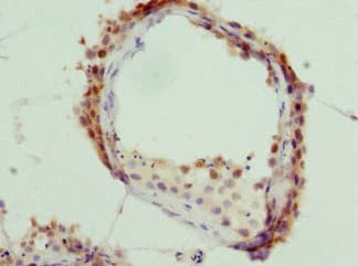 KHDRBS3 / SLM2 Antibody