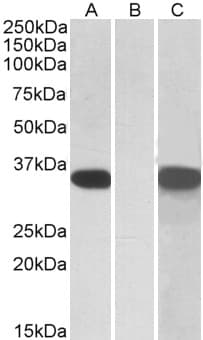 IHC-plus™ Polyclonal Goat anti-Human CRISP2 / TSP1 Antibody (aa81-93, IHC, WB)
