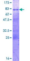 Human SOX12 Protein (Recombinant GST)