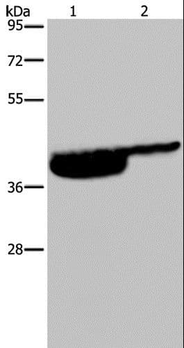P2RX3 / P2X3 Antibody