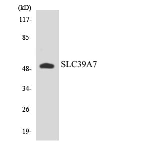 IHC-plus™ SLC39A7 / ZIP7 Antibody (aa120-169)