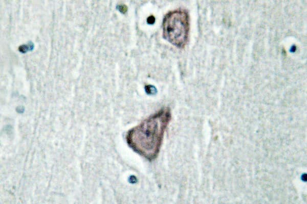 CDH3 / P-Cadherin Antibody (Gly78)