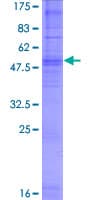 Human OR5T1 Protein (Recombinant GST)