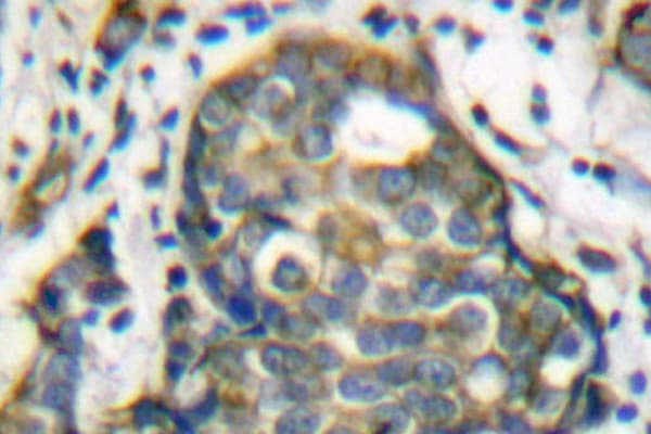 KRT8 / CK8 / Cytokeratin 8 Antibody (Val67)