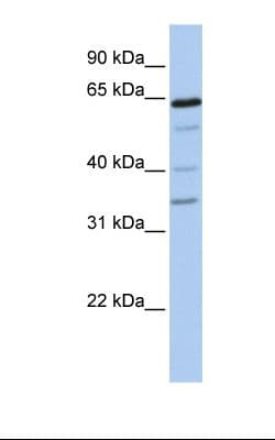 GALNT16 / GALNTL1 Antibody (aa74-123)