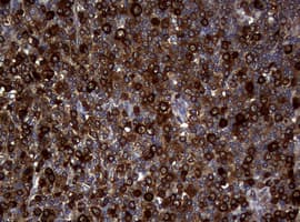 NME1 / NM23 Antibody (clone OTI6E9)