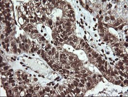 DNM1L / DRP1 Antibody (clone OTI2E7)