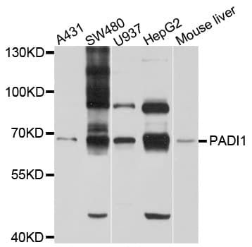Polyclonal Rabbit anti-Human PADI1 Antibody (WB)