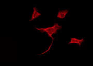 Polyclonal Rabbit anti-Human Spastic / GLRB Antibody (IF, WB)